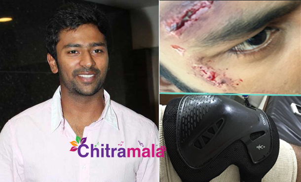 Shantanu Injured